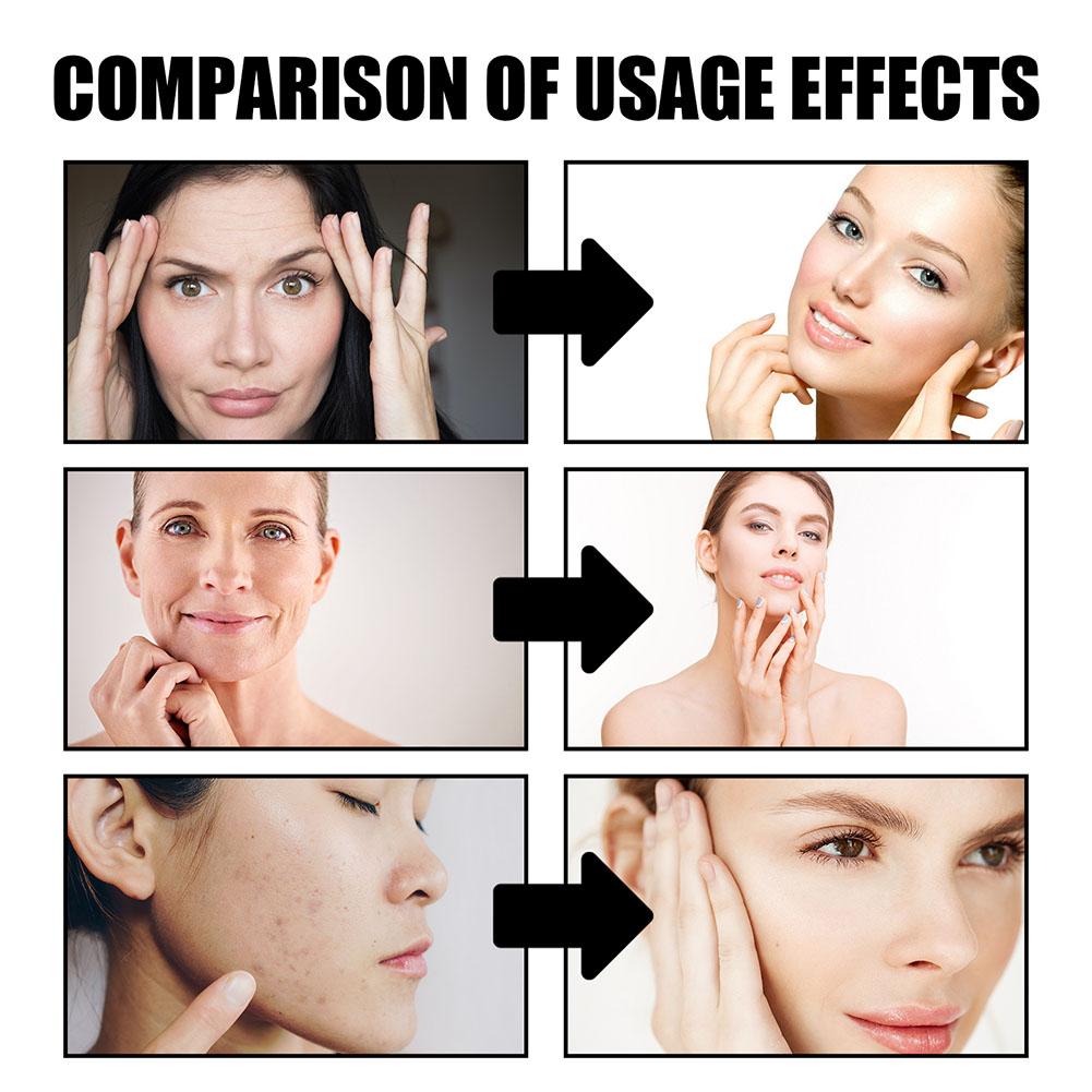 Krem ze smoczej krwi Usuwanie  – Retinol Cream recenzja i cena