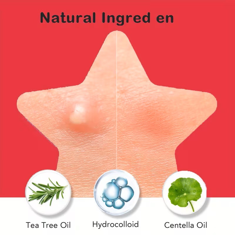 200/400 szt. Plastry na trądzi – Face Oil recenzja i cena